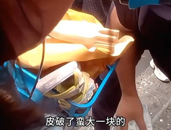 看著都疼<strong></p>
<p>西鳳酒
</strong>！上海街頭一男子突然求助：10歲女兒被死死卡?。∵@個(gè)行為太危險(xiǎn)→:西鳳酒
