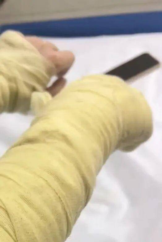 湖南一女主播被偽裝的包裹炸傷<strong></p>
<p>西鳳酒
</strong>，永州公安：正在核實(shí)具體情況:西鳳酒
