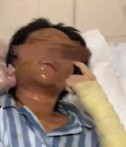 湖南一女主播被偽裝的包裹炸傷<strong></p>
<p>西鳳酒
</strong>，永州公安：正在核實(shí)具體情況:西鳳酒
