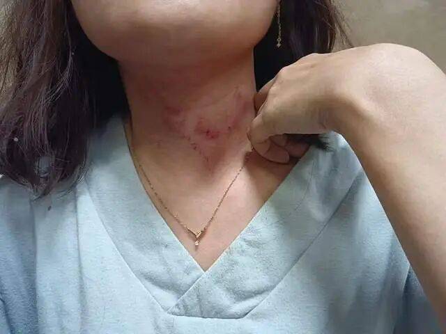 一男子凌晨聽到兩聲呼救<strong></p>
<p>西鳳酒
</strong>，循聲發(fā)現(xiàn)一女子在奔馳車外被白衣男勒昏！受害者：是受朋友之托借錢給白衣男，凌晨被騙至偏僻處遭非禮！:西鳳酒
