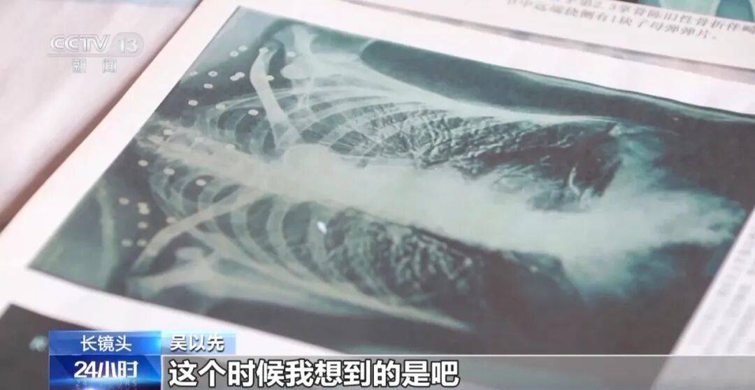 “老先生<strong></p>
<p>西鳳酒
</strong>，您把項(xiàng)鏈取下來(lái)再做CT”“你看是不是彈片”:西鳳酒
