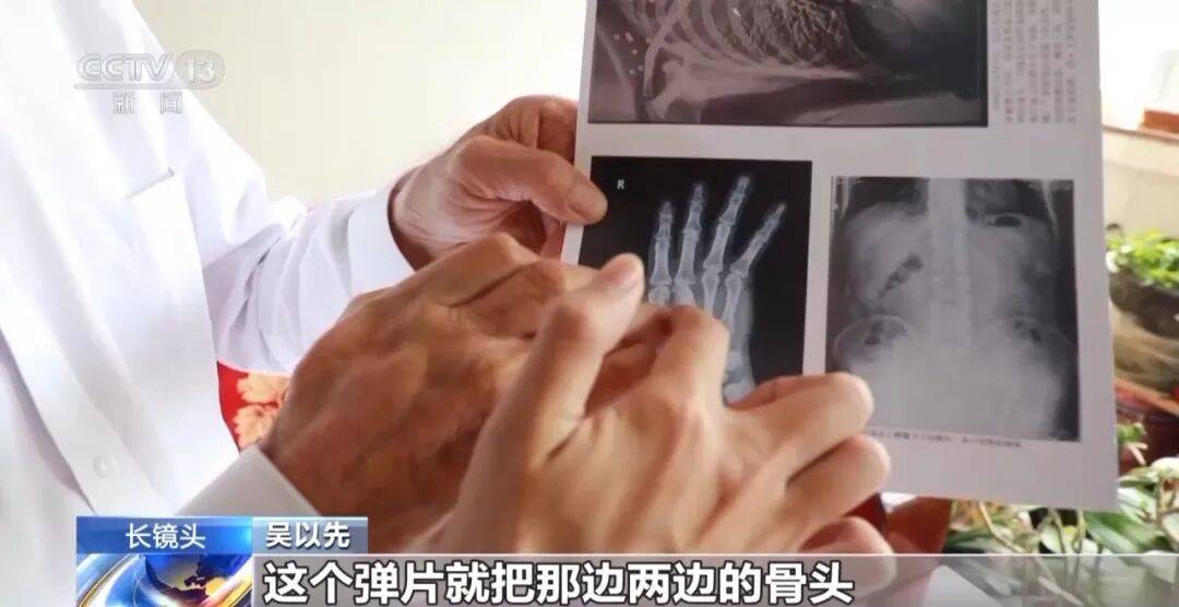 “老先生<strong></p>
<p>西鳳酒
</strong>，您把項(xiàng)鏈取下來(lái)再做CT”“你看是不是彈片”:西鳳酒
